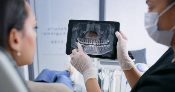 Licensed Teeth Whitening service in East Cleveland, OH - Smile Center Dentistry